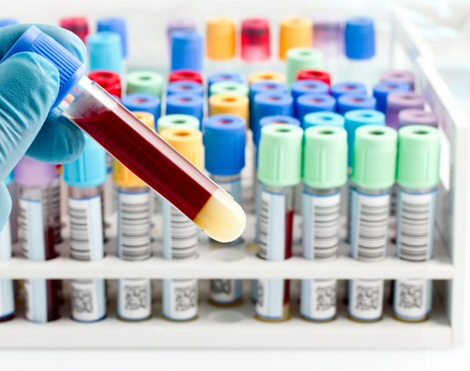 تدوین استاندارد ملی ظروف یک‌بارمصرف برای جمع‌آوری آزمونه خون وریدی انسان